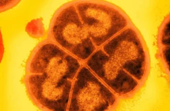 Deinococcus radiodurans